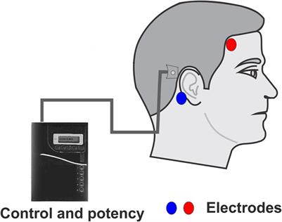 Use of galvanic vestibular stimulation device as a countermeasure for microgravity effects in spaceflight